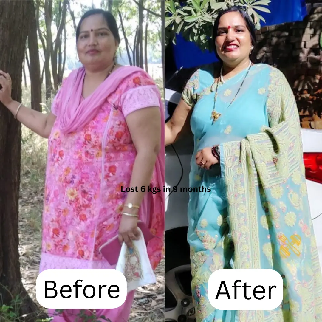 Transformation 10
